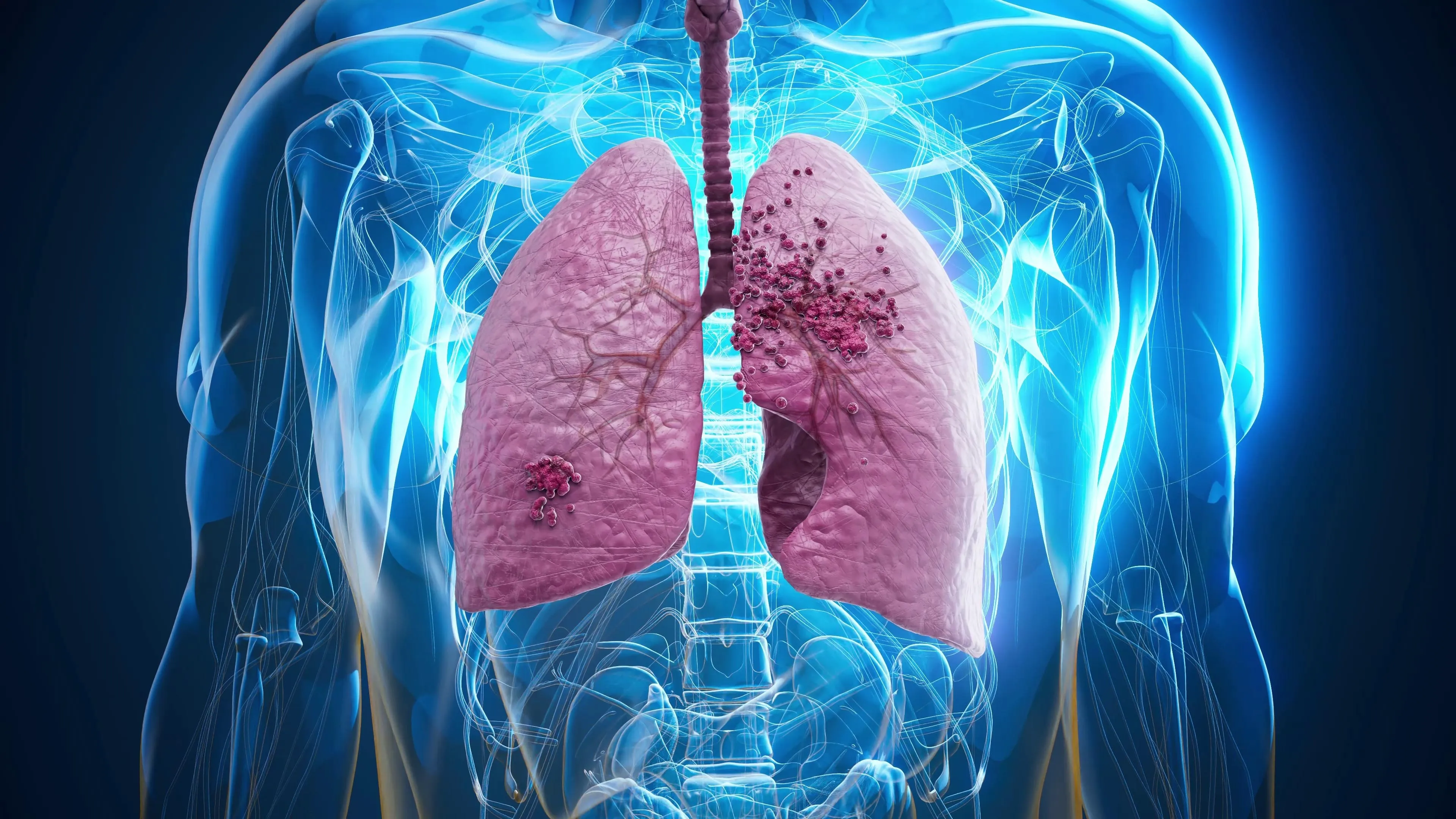 Human Health Lung